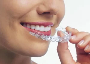 Invisalign - Smile Center