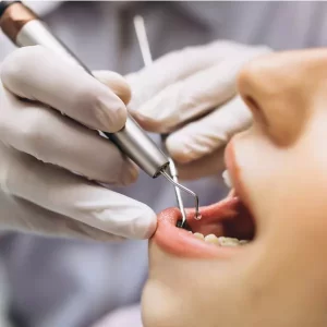 Dental Bone Grafting - Dental Services