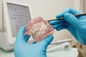Oral Appliances - Dental Services with Smile Center